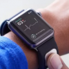 第一款真正的Apple Watch医疗配件刚刚获得监管机构的批准