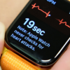 苹果AppleWatch成功检测出医院心电图遗漏的严重心脏问题